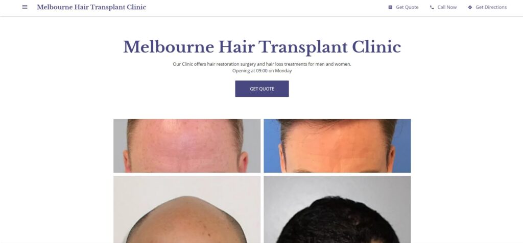 10+ Best Hair Transplantation Clinics in Melbourne, Victoria [2022]